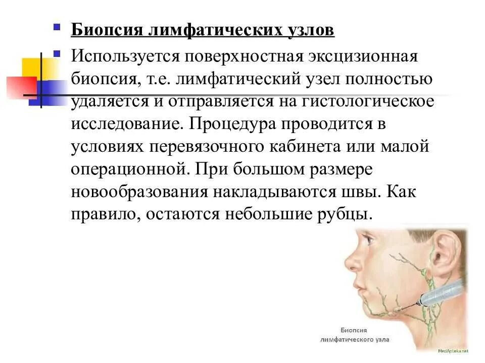 Лимфатические узлы врач какой