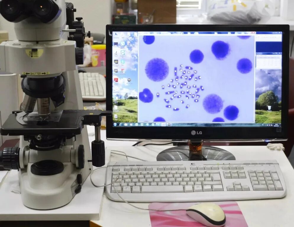 микроскоп сканирующий (сканер микропрепаратов). Levenhuk rainbow dm500 lcd. микроскоп электронный digital blue qx5. цифровой микроскоп возможности. атн 452 микроскоп.