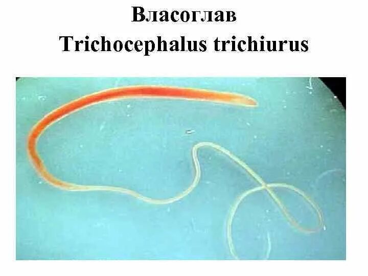 Власоглав человеческий (Trichocephalus Trichiurus). Власоглав препарат под микроскопом.