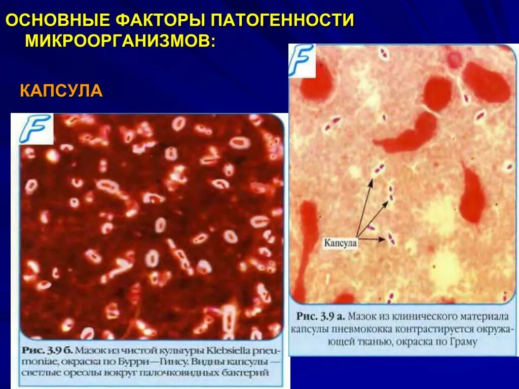 Факторы патогенных микробов микробиология. Факторы вирулентности микробов микробиология. Патогенность микроорганизмов микробиология. Основные факторы патогенности микроорганизмов. Группы патогенных организмов