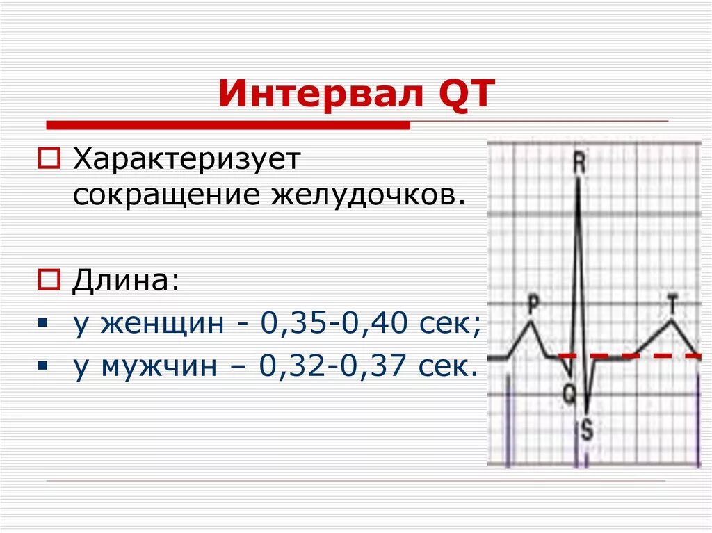 Удлиненное qt на экг. Нормальный интервал qt на ЭКГ норма. Показатель qt на ЭКГ норма. Интервал qt на ЭКГ норма у женщин. Интервал qt на ЭКГ норма.