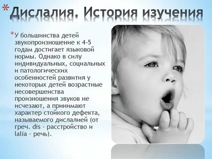 Дислалия у детей что