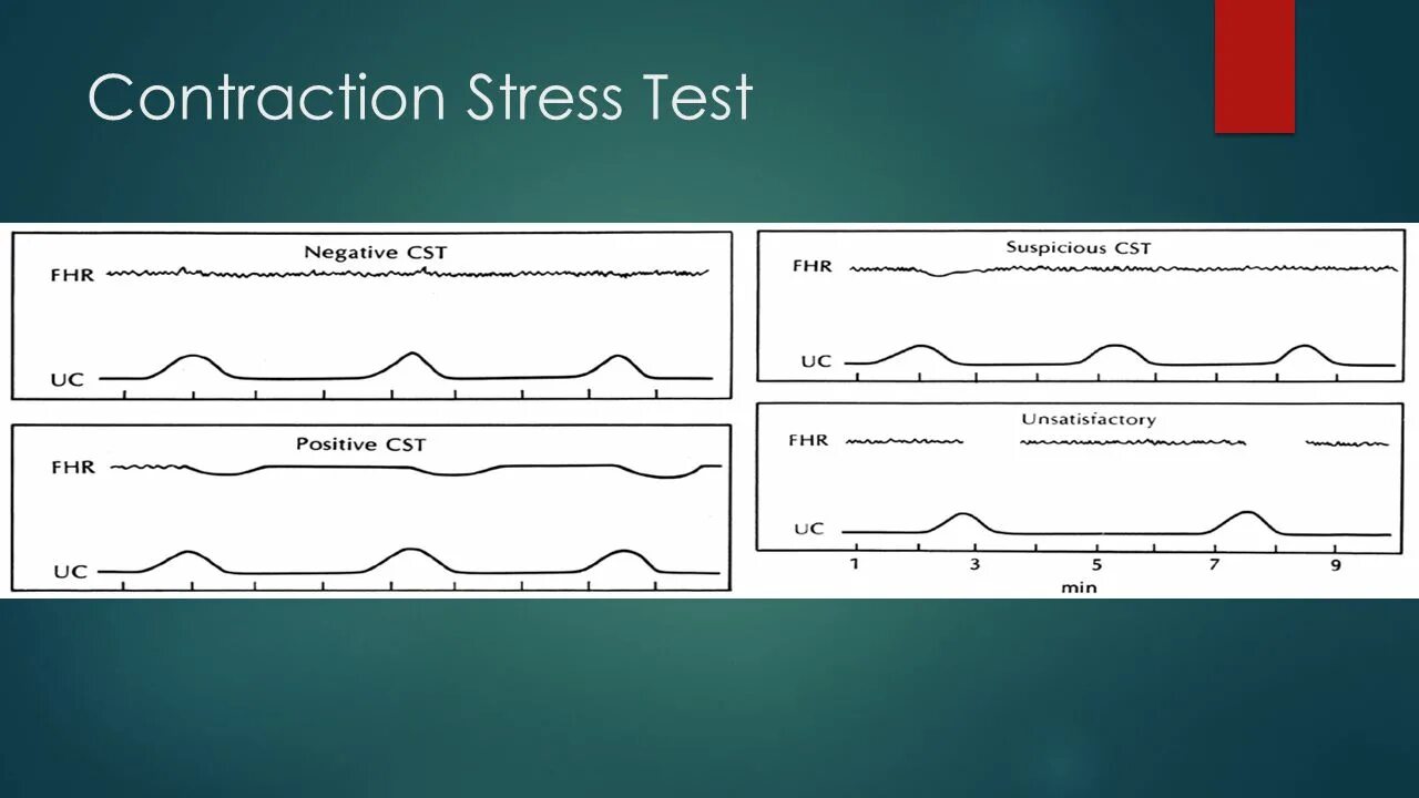 Терпит тест. Циклотимия тест. Стресс тест. Stress Test для конструкций. Циклотимия лекция.