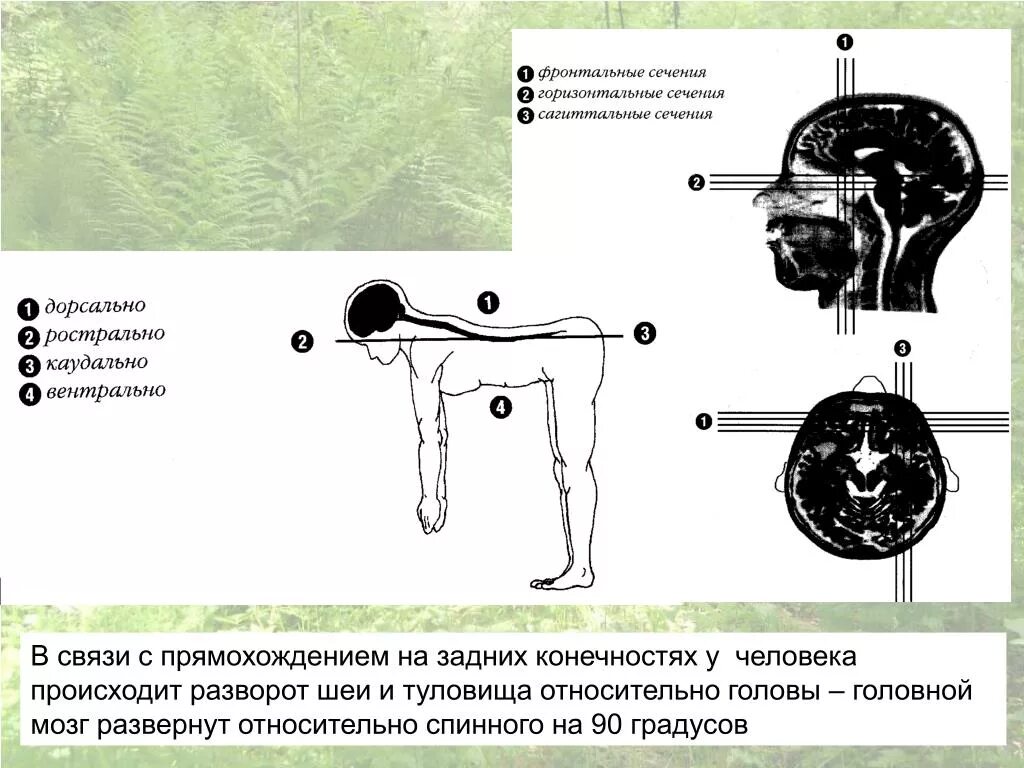 Дорсальное расположение это. Вентральный и дорсальный. Вентральное расположение это. Дорсальный это в анатомии. Каудальное направление