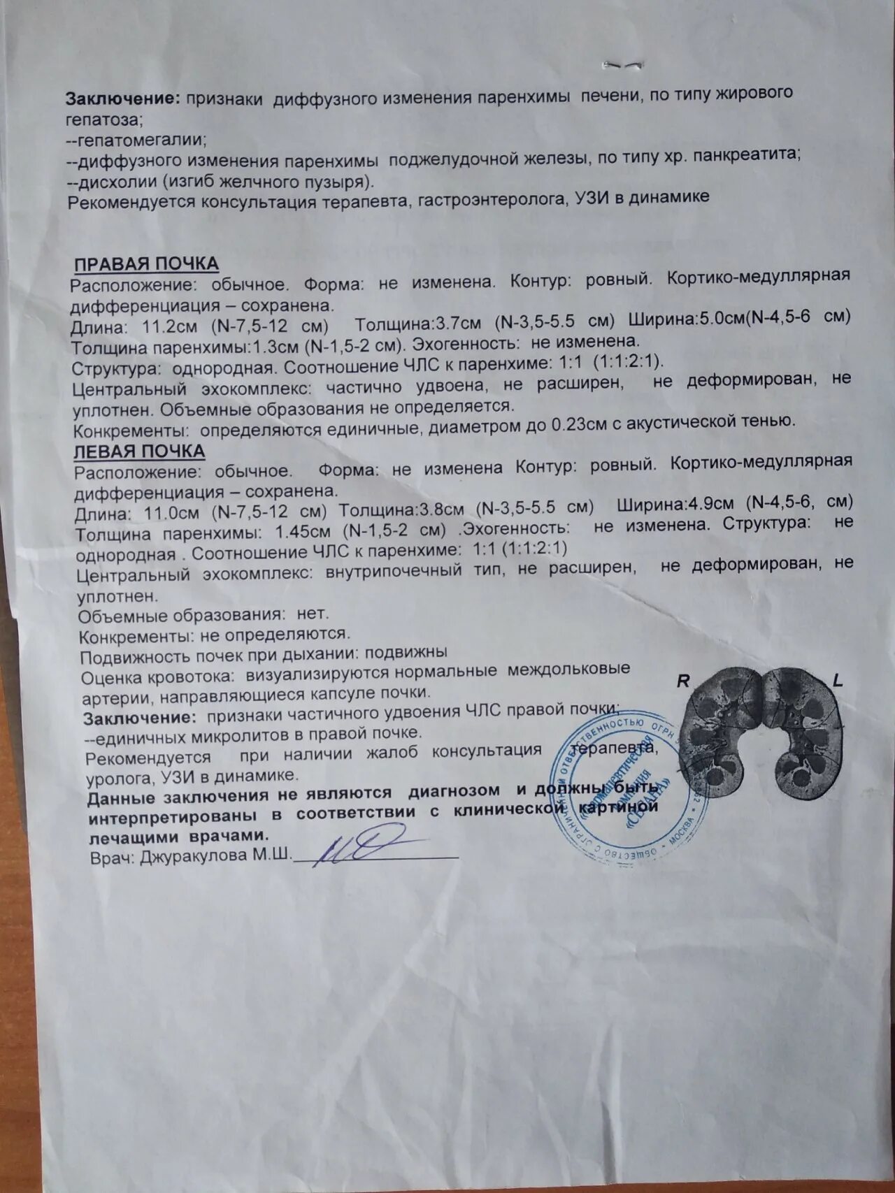Уплотнена деформирована
