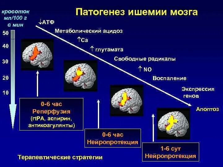 Ишемия мозга дают ли инвалидность. Ишемия мозга дают ли инвалидность
