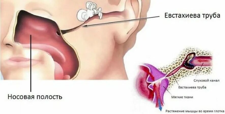 Евстахиева труба соединяет полость среднего уха с носоглоткой. Анатомия уха и евстахиевой трубы. Евстахиева труба и носоглотка.