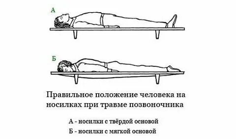 Поза при травме позвоночника