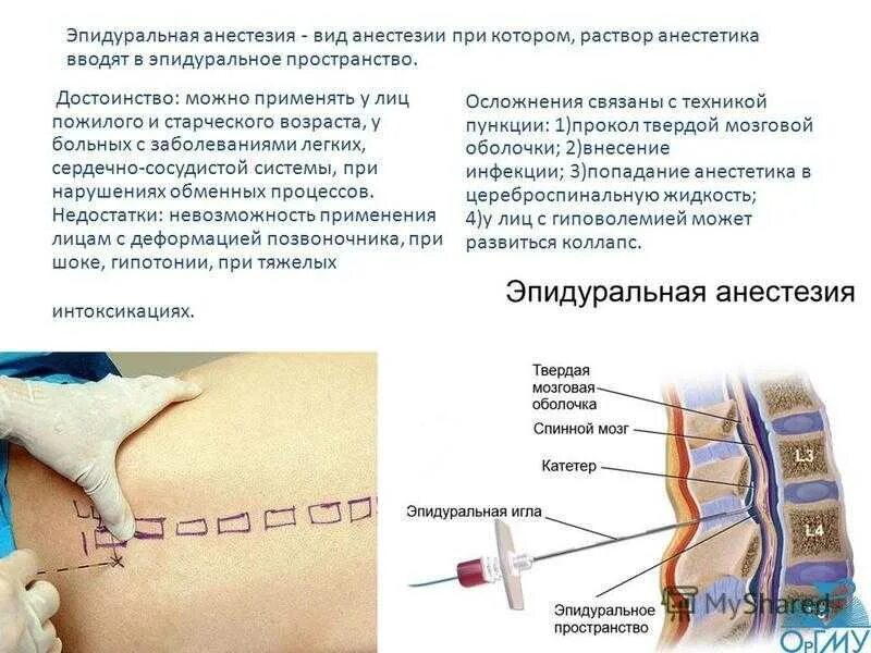 Можно ли ставить блокаду