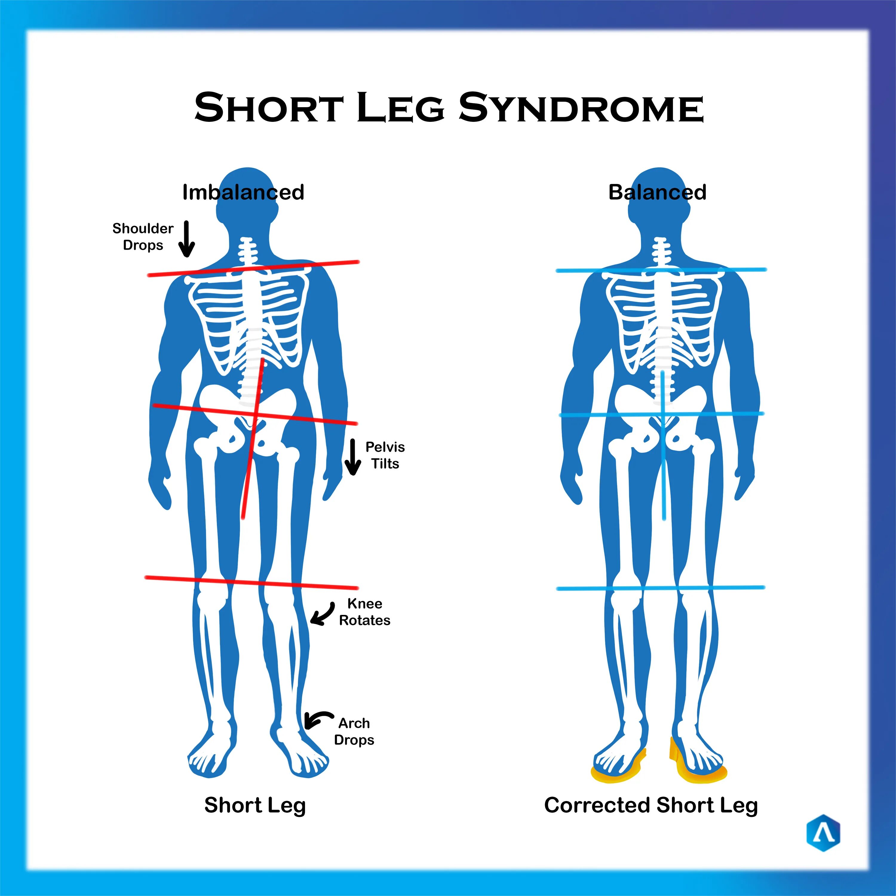 A legs перевод. Карточка нога. Legs перевод. Leg рисунок. Break a leg idiom.
