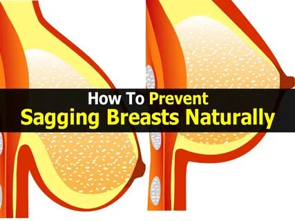 How To Prevent Sagging Breasts Naturally.