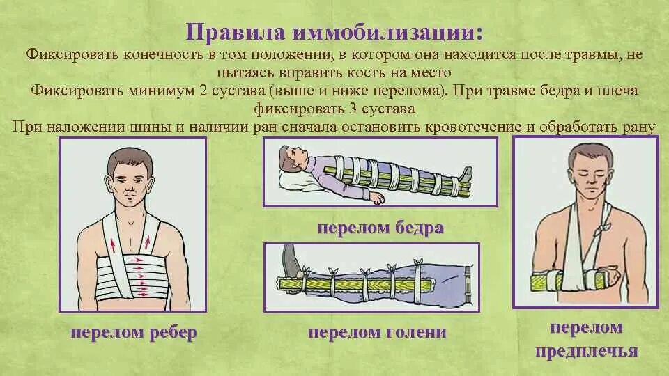 При открытом переломе необходимо ответ. Средства транспортной иммобилизации при переломах конечностей. Осуществление транспортной иммобилизации при переломах конечностей. Транспортная иммобилизация при переломах костей. Мобилизация конечности при переллмах.