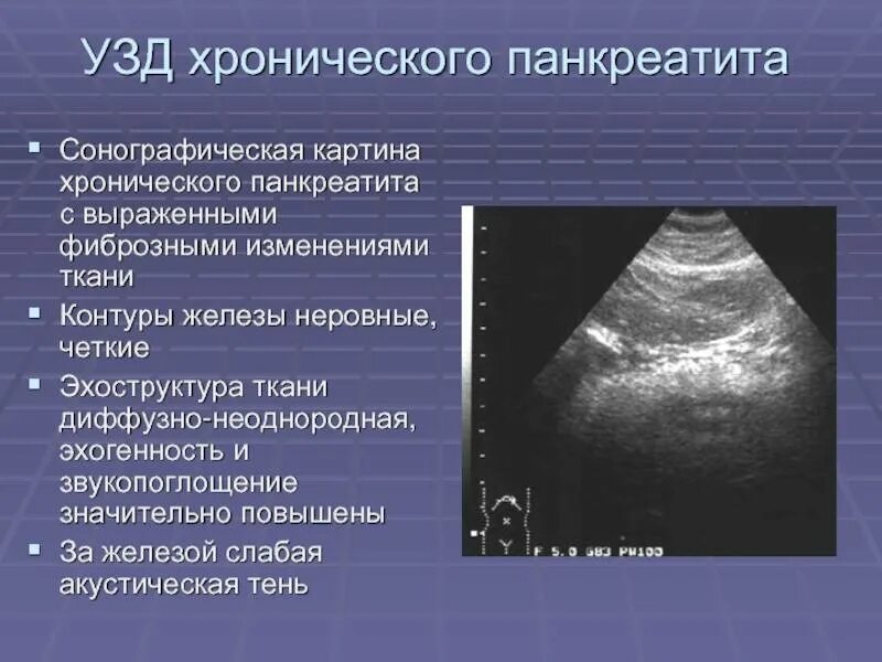Что такое эхогенность паренхимы железы