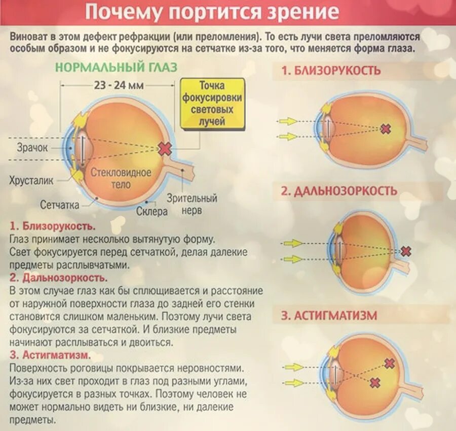 Падает зрение после 40