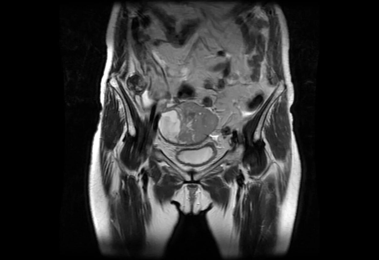 Мрт тазовой области. Мрт омт малого таза. Снимки мрт омт. Мрт малого таза сергея березина. Мрт малого таза с внутривенным контрастированием.