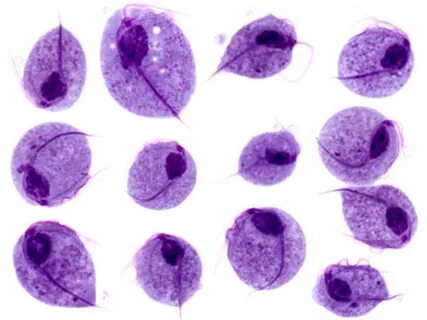 Trichomonas vaginālis