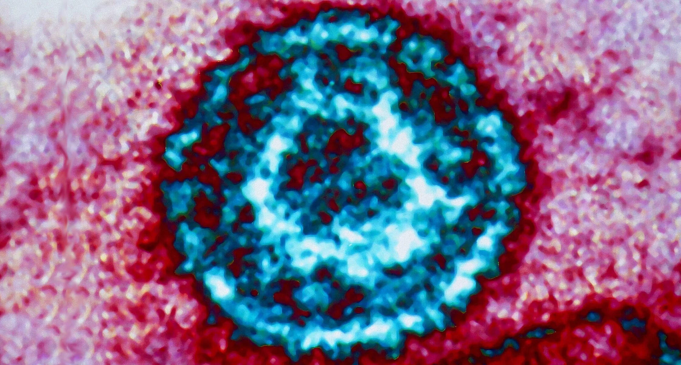 Epstein barr virus ebna. Вирус Эпштейна-Барр под микроскопом. Герпесвирус вирус Эпштейна-Барр.