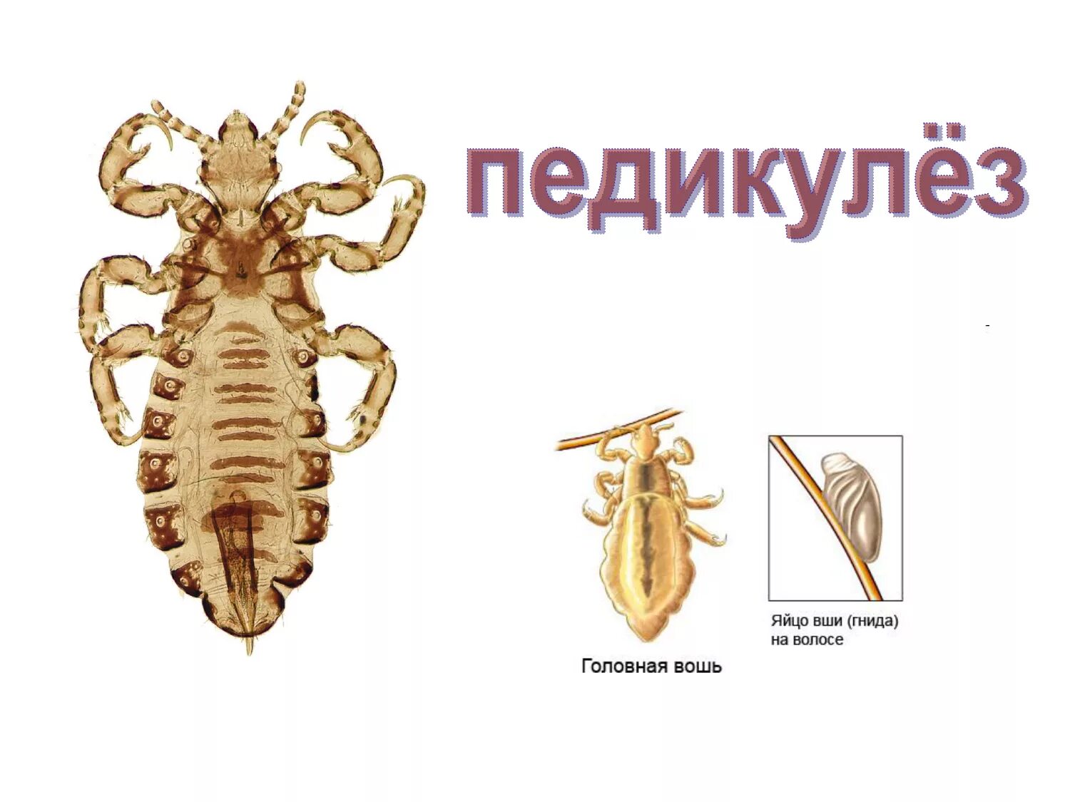 Педикулез презентация. Вши презентация. Педикулез возбудитель. Вши презентация. Презентация про вшей.