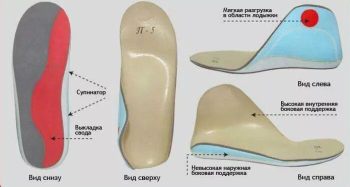 Пятки внутрь. Ортопедические стельки вальгусная деформация стопы. Стельки супинатор вальгус. Варусная деформация стельки. Стельки при варусной деформации стопы.