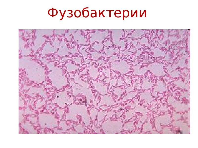 Fusobacterium spp. Fusobacterium spp микроскопия. возбудитель некробактериоза - fusobacterium necrophorum. фузобактерии (род fusobacterium). fusobacterium nucleatum морфология.