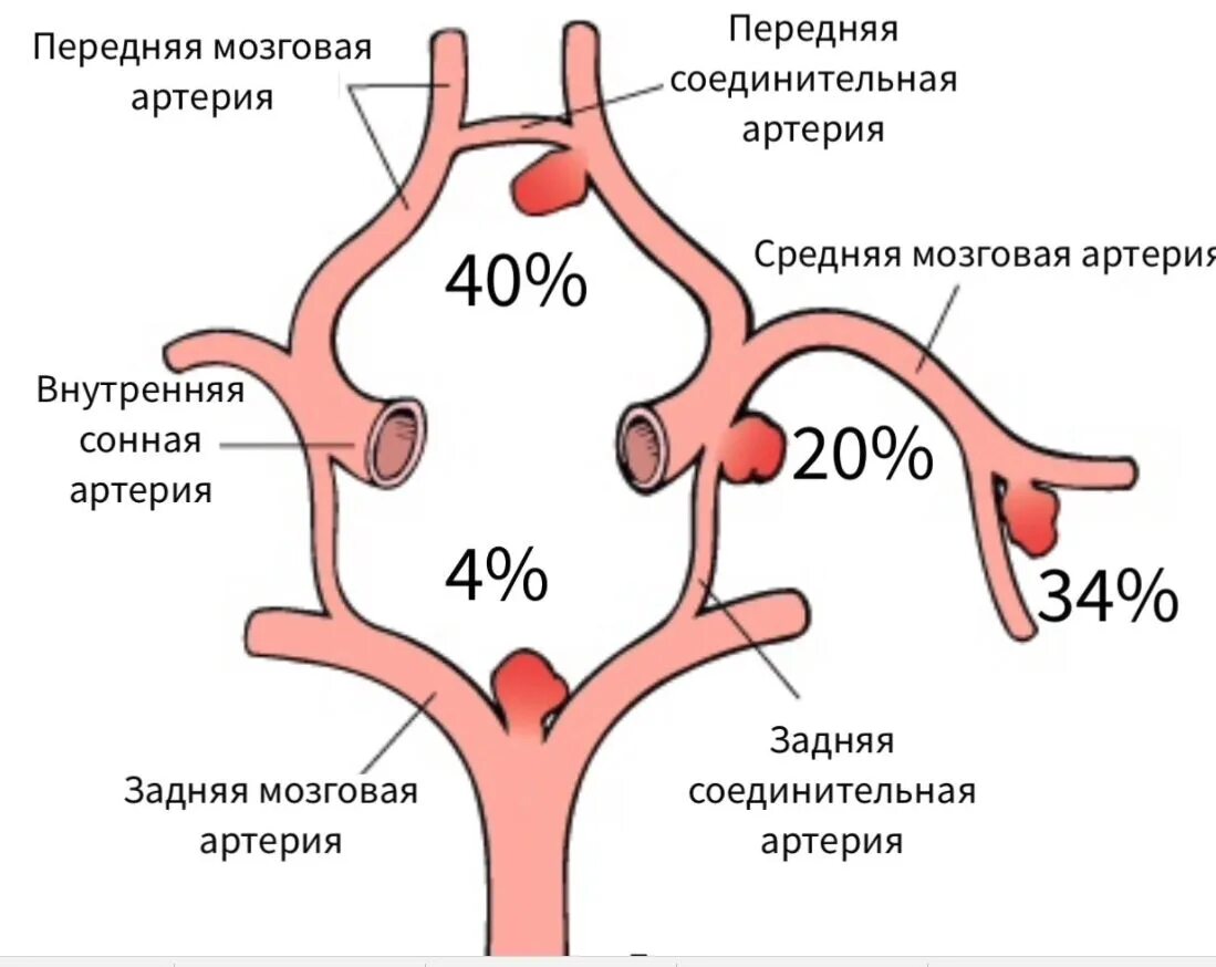 Артерии круг головного мозга. Соединительная артерия головного. Передняя соединительная артерия головного мозга аневризма. Артерии головного мозга Виллизиев круг схема. Виллизиев круг задние соединительные артерии.