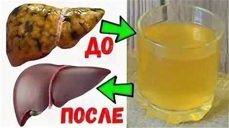 Как почистить печень от жира