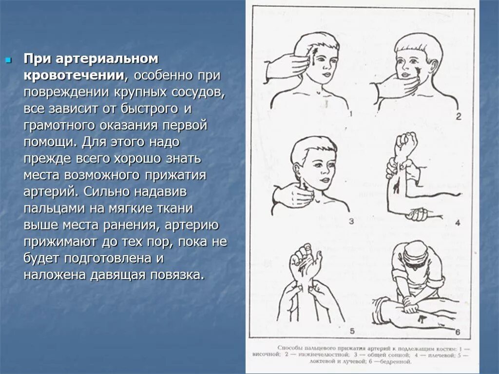 Первая помощь при ране атретрии. Оказание первой помощи при кровотечении головы. Оказание 1 помощи при повреждении сосудов.