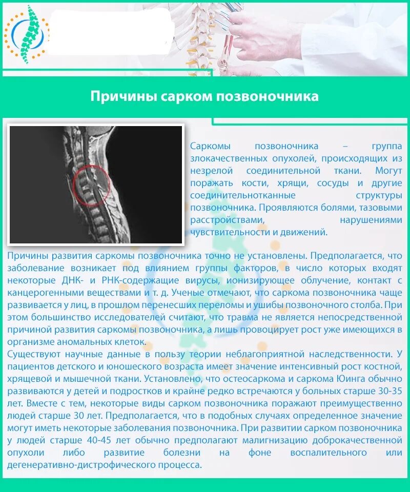 Рак поясницы. Саркома позвоночника симптомы. • Опухолевые поражения позвоночника.