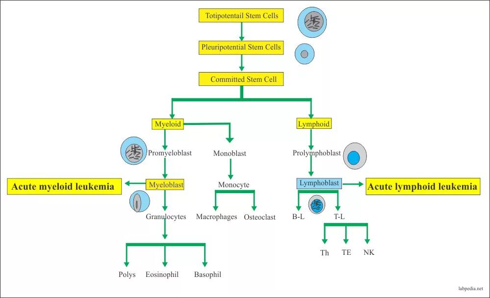 Aml проверка cryptozen. Acute Leukemia classification. Diagnostic acute myeloid. History of treatment of acute lymphoblastic Leukemia американские горки. Acute Leukemia pathomorfology.