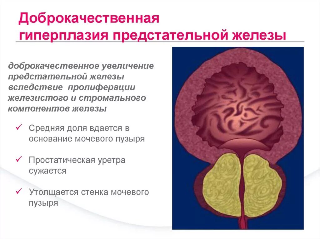 Пара простата
