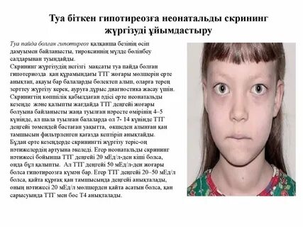 Гипотиреоз у подростка