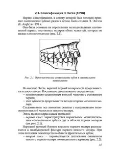 Ортодонтия классификация