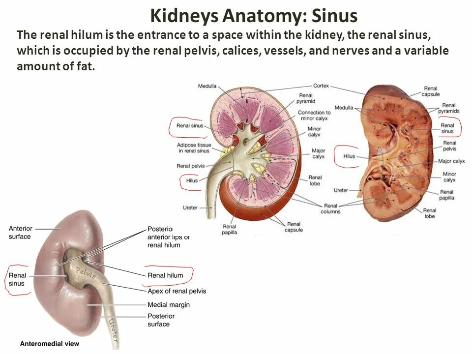 Изменение синусов обеих почек. Синус почки. Почки анатомия Sinus renalis. Kidney Anatomy. Строение почки синус.