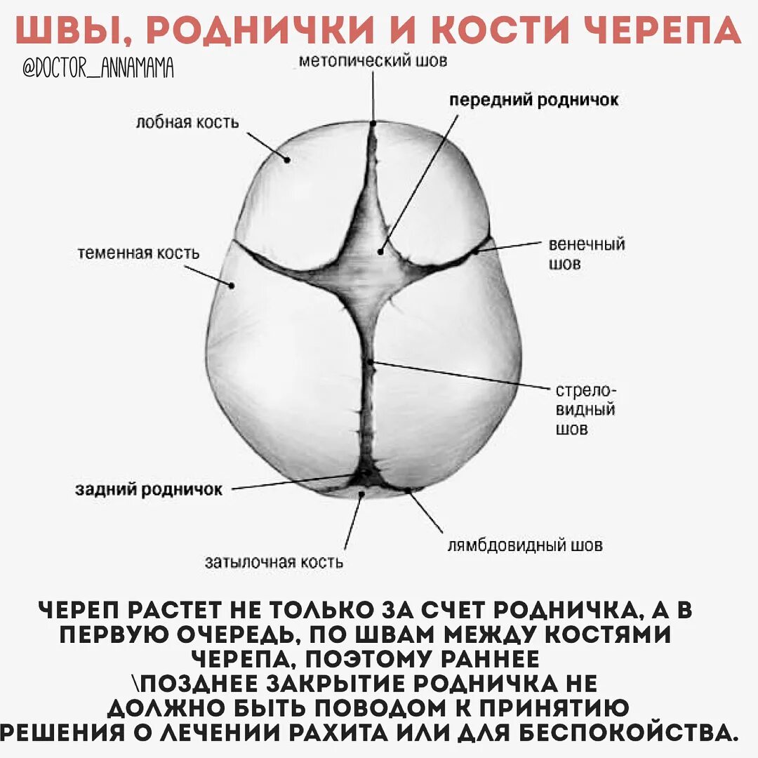 Швы большого родничка. Соединение костей черепа роднички. Швы и роднички черепа. Стреловидный шов черепа новорожденного норма. Роднички новорожденного анатомия черепа.