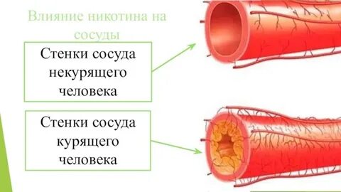 Курение сужение сосудов