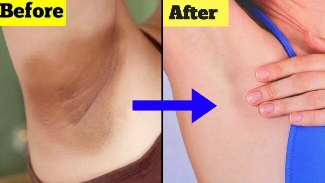 No mas flacidez en el cuello gracias a este remedio casero que te presento #serv