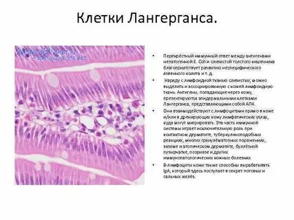 Клетки лангерганса