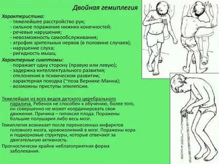 Дцп гемиплегия спастическая форма