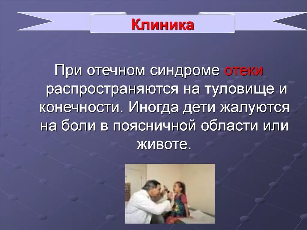 Отечный синдром характерен для