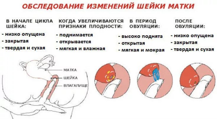 Ощущение выпадение матки как это наглядный пример Смещение матки: разновидности, типы, выраженность отклонения