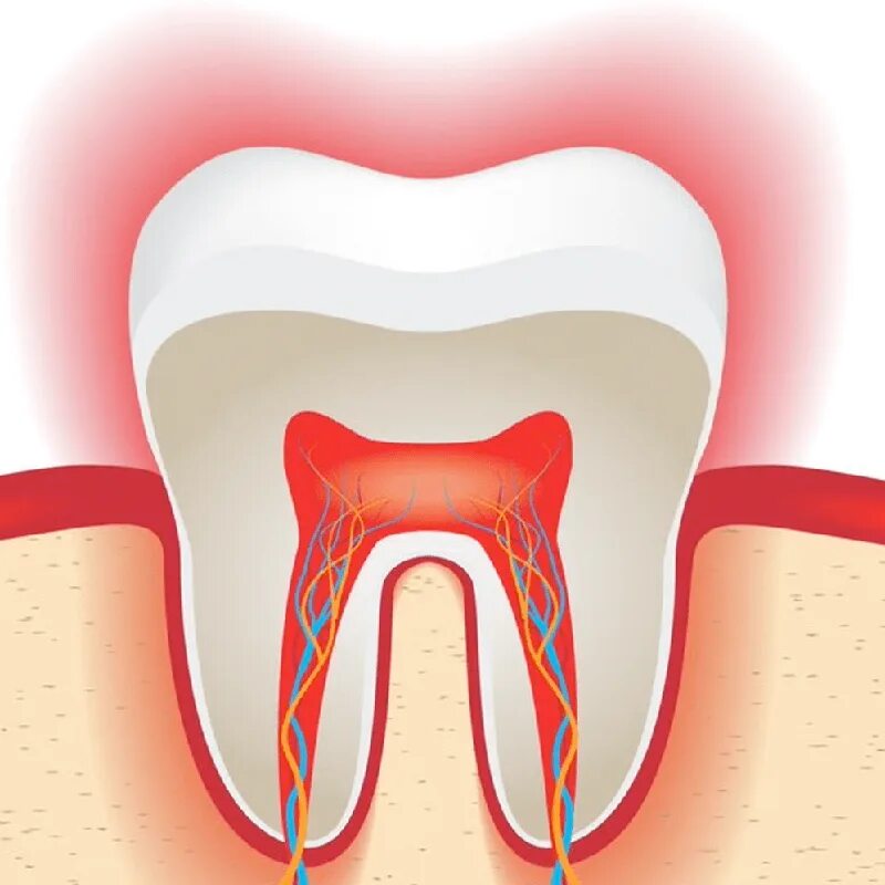Почему чувствительность зуба. Гиперестезия твердых тканей зуба. Чувствительная эмаль зубов.