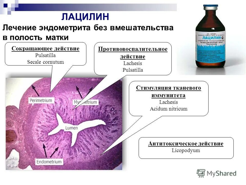 Можно ли по собственному желанию удалить матку. Лечение хронического эндометрита схема препараты. Лечение хронического эндометрита схема лечения. Схема лечения хронического эндометрита. Схема лечения хронического эндометрита у женщин.