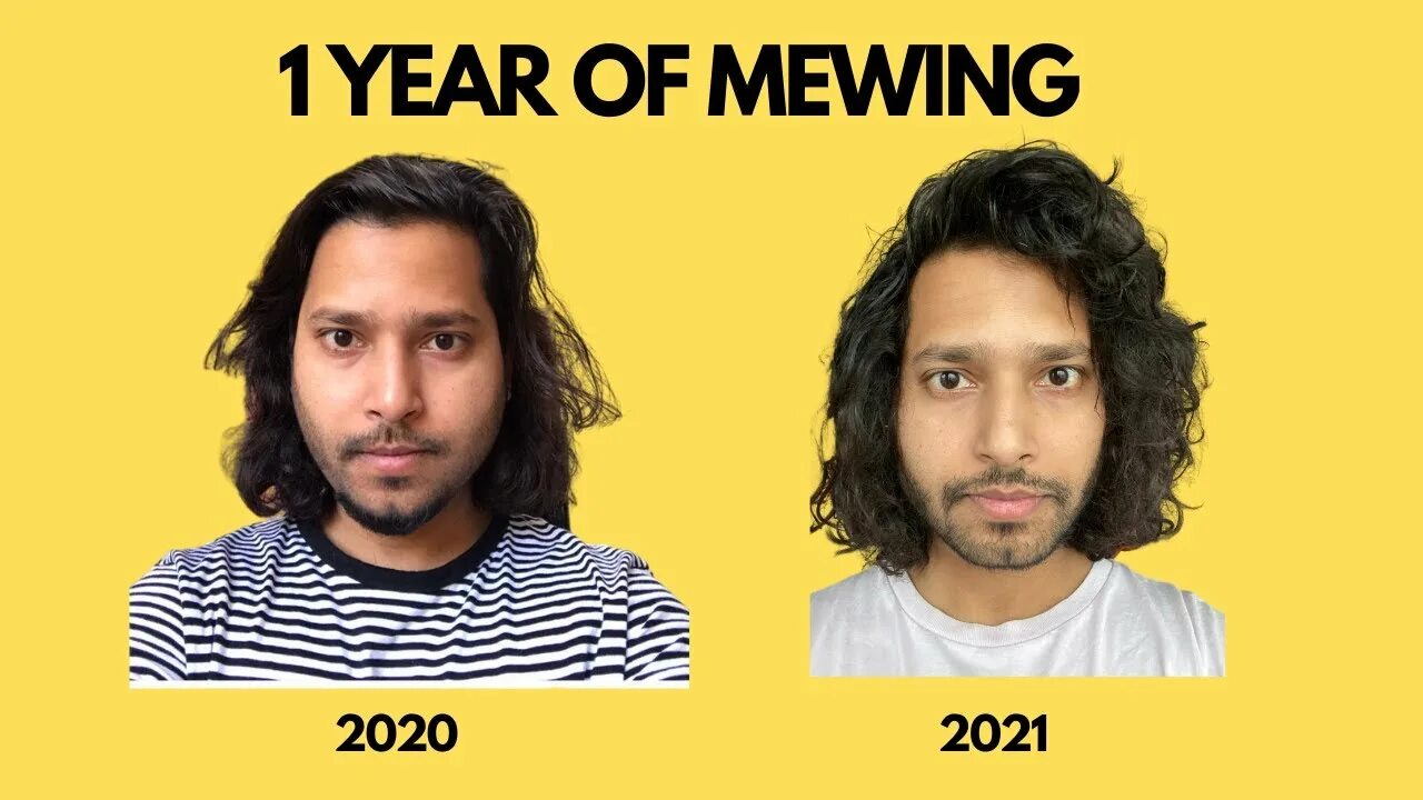 Mewing. Mewing before and after. Mewing Transformation. ASTROSKY mewing.