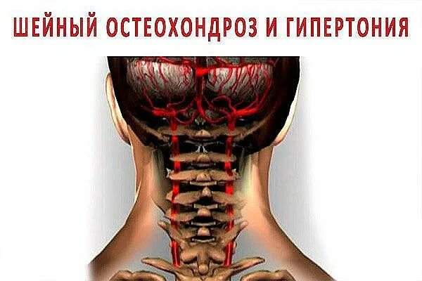 90 % трудоспособного населения страдает от шейного остеохондроза.... Интересный 
