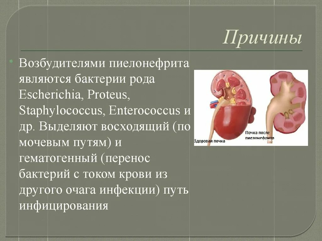 Возбудители пиелонефрита. Возбудители хронического пиелонефрита. Основной возбудитель пиелонефрита. Возбудителями пиелонефрита являются. Пиелонефрит температура 38