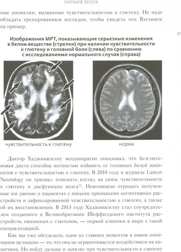 Перлмуттер еда и мозг. Книга про еду и мозг. Еда и мозг книга. Еда и мозг. Что углеводы делают.