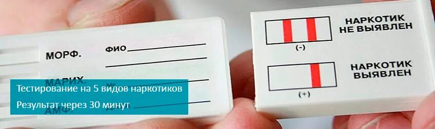 Сдача анализов у нарколога. Тест на наркотики. положительный тест на наркотики. тест на выявление наркотиков. тест у нарколога.