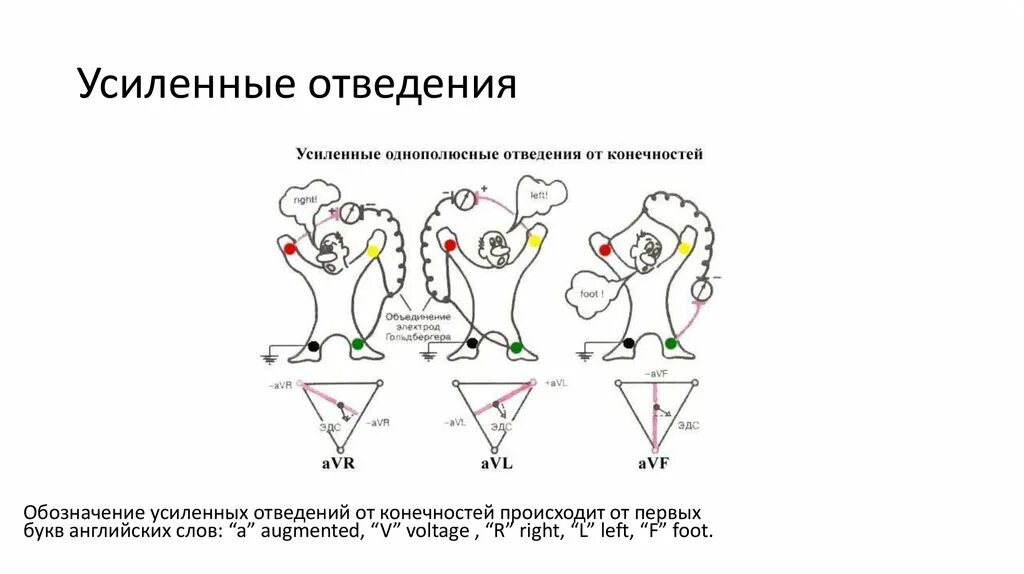 Avr отведение экг. Стандартные и усиленные отведения экг. усиленные униполярные отведения.