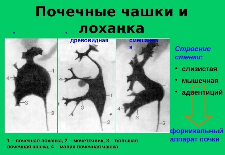 Почечная лоханка строение. Лоханка почка анатомия строение. Типы строения лоханки почки. Типы строения почечных лоханок.