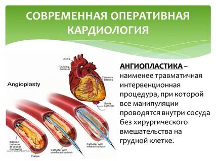 Лечение сердечным болезням
